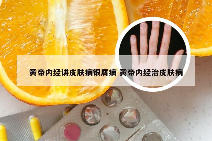 黄帝内经讲皮肤病银屑病 黄帝内经治皮肤病