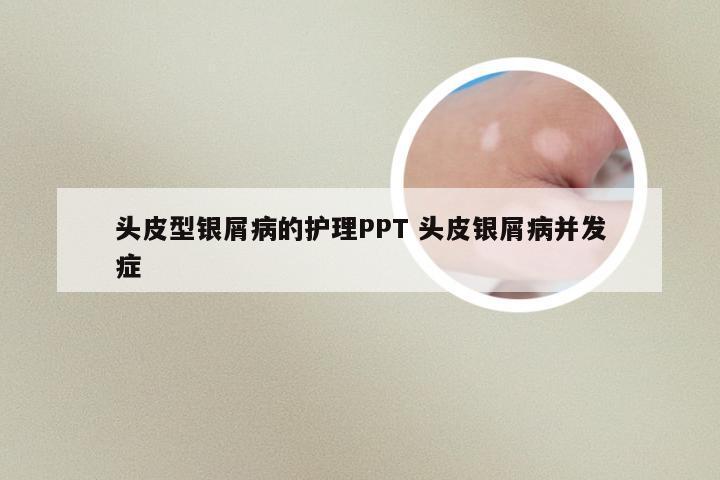 头皮型银屑病的护理PPT 头皮银屑病并发症