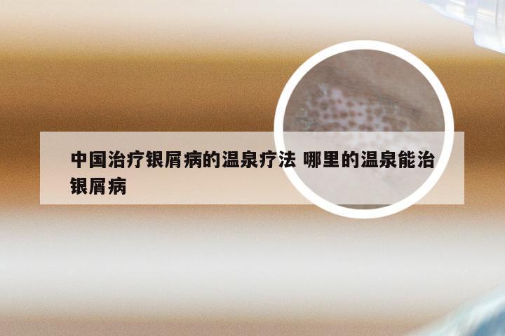 中国治疗银屑病的温泉疗法 哪里的温泉能治银屑病