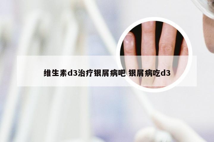 维生素d3治疗银屑病吧 银屑病吃d3