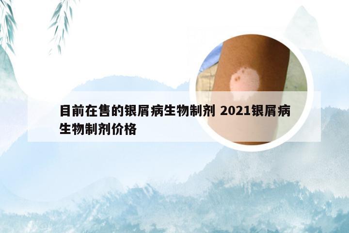 目前在售的银屑病生物制剂 2021银屑病生物制剂价格