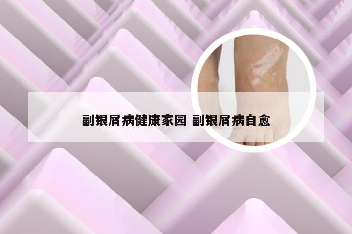 副银屑病健康家园 副银屑病自愈