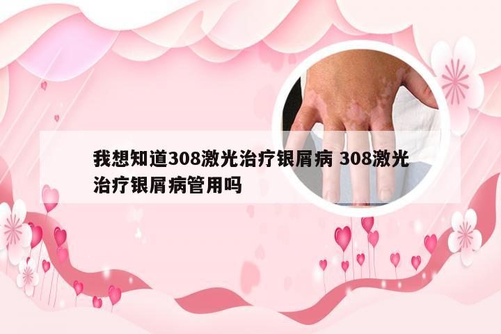 我想知道308激光治疗银屑病 308激光治疗银屑病管用吗
