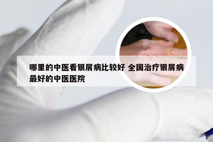哪里的中医看银屑病比较好 全国治疗银屑病最好的中医医院