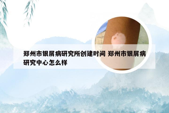 郑州市银屑病研究所创建时间 郑州市银屑病研究中心怎么样