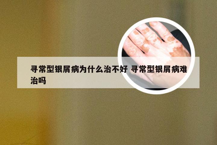 寻常型银屑病为什么治不好 寻常型银屑病难治吗