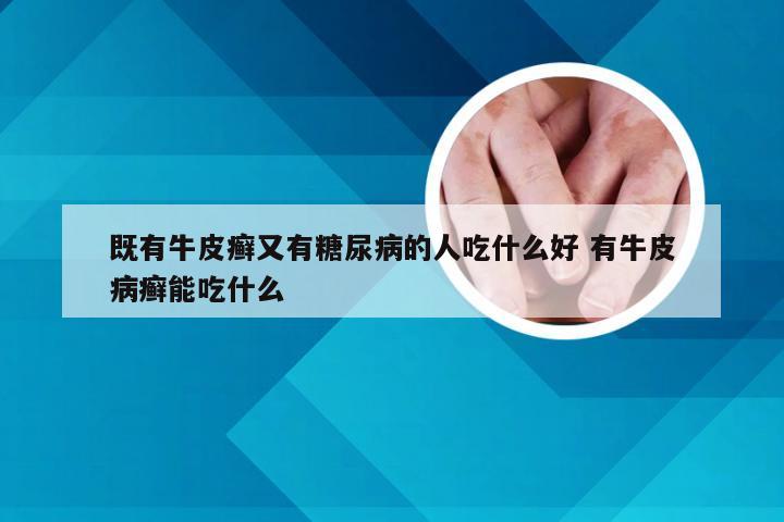 既有牛皮癣又有糖尿病的人吃什么好 有牛皮病癣能吃什么