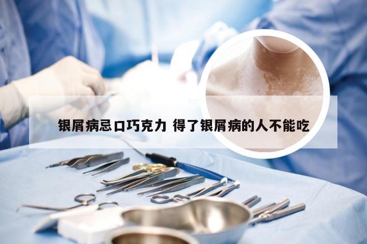 银屑病忌口巧克力 得了银屑病的人不能吃