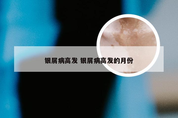 银屑病高发 银屑病高发的月份