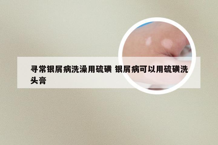 寻常银屑病洗澡用硫磺 银屑病可以用硫磺洗头膏