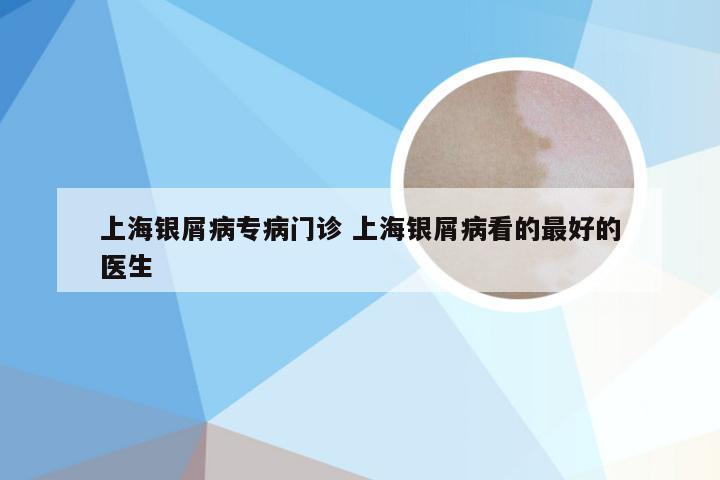 上海银屑病专病门诊 上海银屑病看的最好的医生