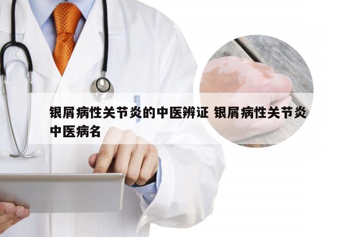 银屑病性关节炎的中医辨证 银屑病性关节炎中医病名