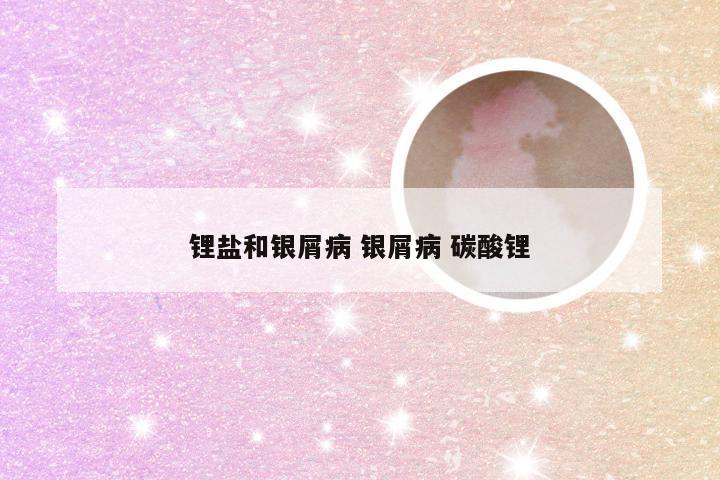 锂盐和银屑病 银屑病 碳酸锂