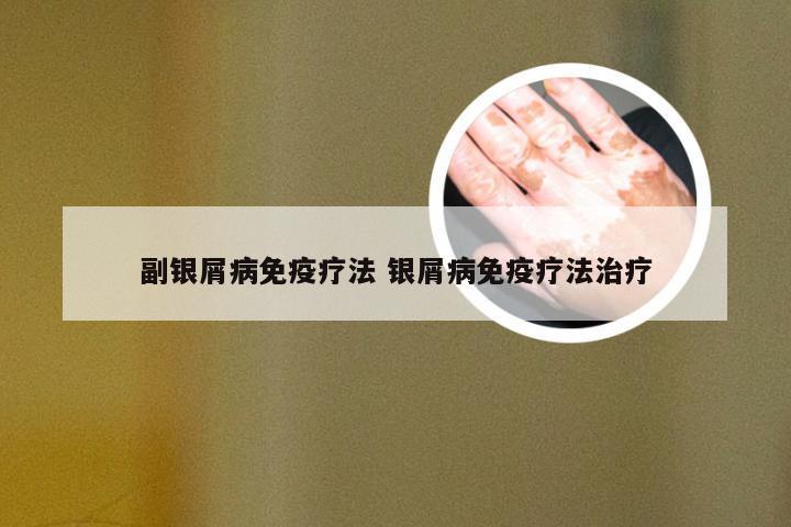 副银屑病免疫疗法 银屑病免疫疗法治疗