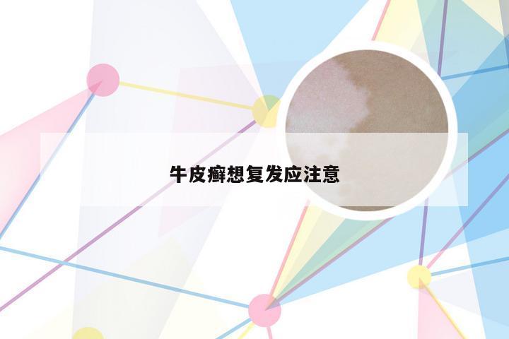 牛皮癣想复发应注意