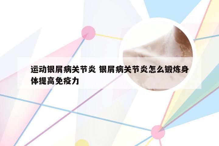 运动银屑病关节炎 银屑病关节炎怎么锻炼身体提高免疫力