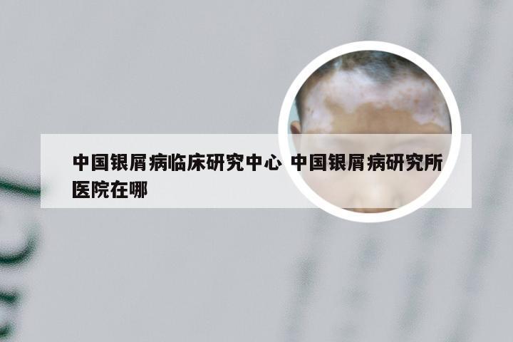 中国银屑病临床研究中心 中国银屑病研究所医院在哪