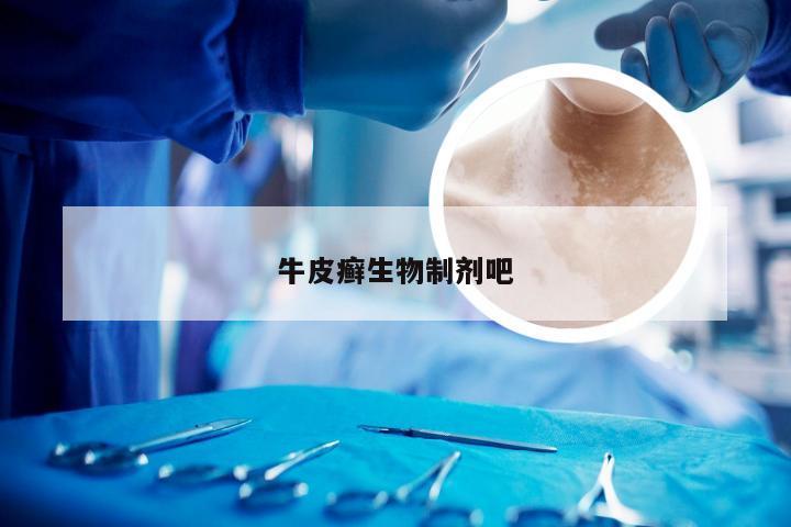 牛皮癣生物制剂吧