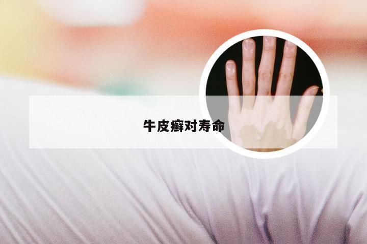 牛皮癣对寿命