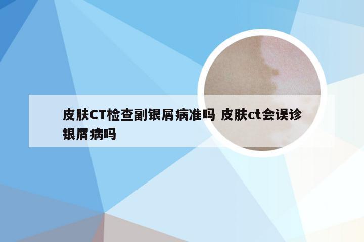 皮肤CT检查副银屑病准吗 皮肤ct会误诊银屑病吗