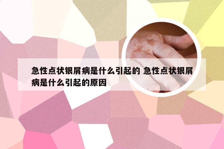 急性点状银屑病是什么引起的 急性点状银屑病是什么引起的原因