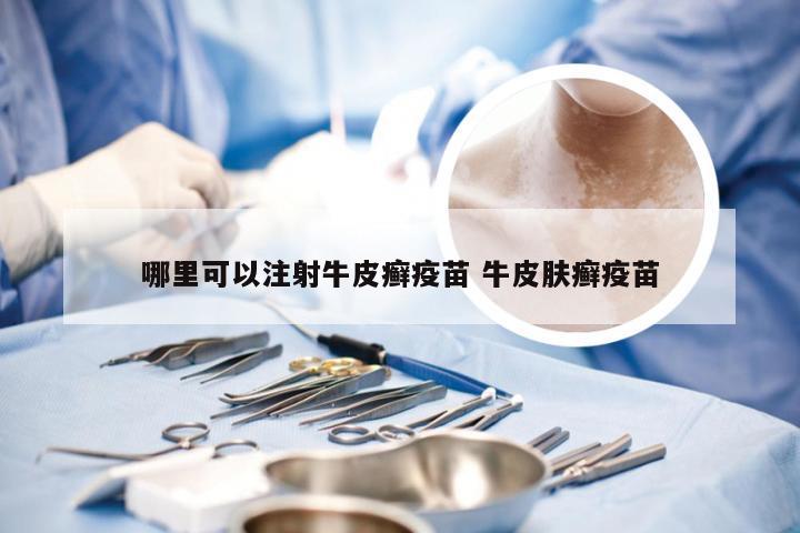 哪里可以注射牛皮癣疫苗 牛皮肤癣疫苗