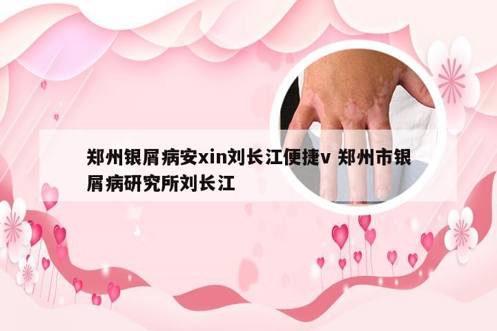 郑州银屑病安xin刘长江便捷v 郑州市银屑病研究所刘长江