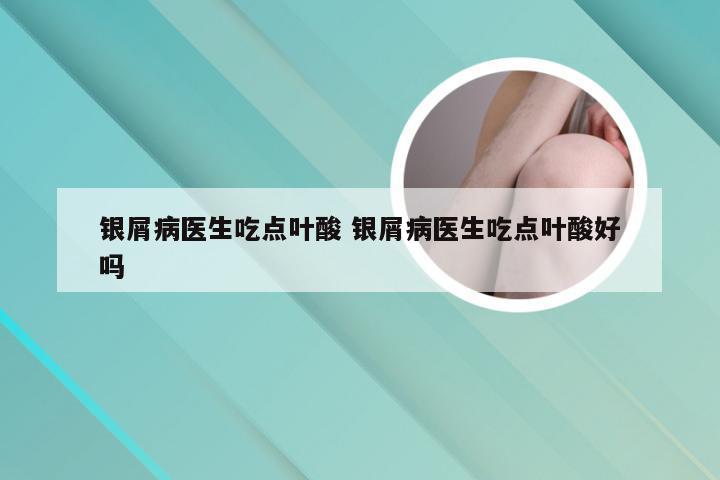银屑病医生吃点叶酸 银屑病医生吃点叶酸好吗