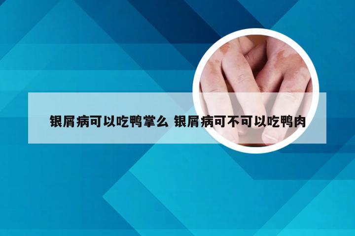 银屑病可以吃鸭掌么 银屑病可不可以吃鸭肉
