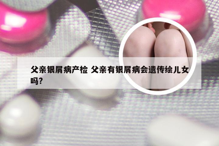 父亲银屑病产检 父亲有银屑病会遗传绘儿女吗?