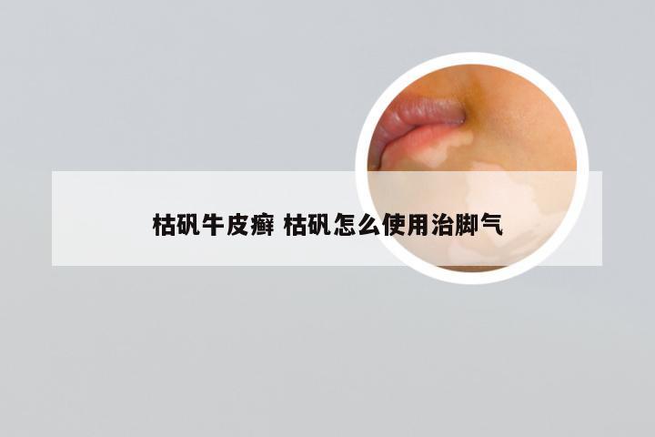 枯矾牛皮癣 枯矾怎么使用治脚气
