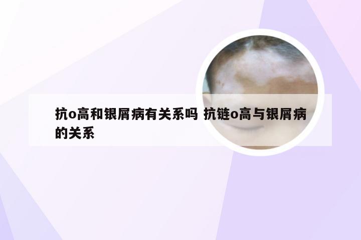 抗o高和银屑病有关系吗 抗链o高与银屑病的关系