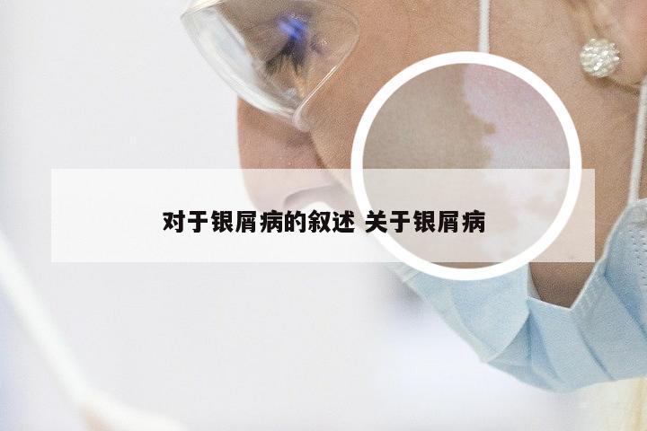 对于银屑病的叙述 关于银屑病