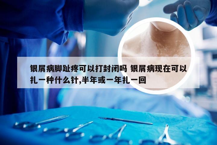 银屑病脚趾疼可以打封闭吗 银屑病现在可以扎一种什么针,半年或一年扎一回