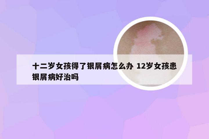 十二岁女孩得了银屑病怎么办 12岁女孩患银屑病好治吗