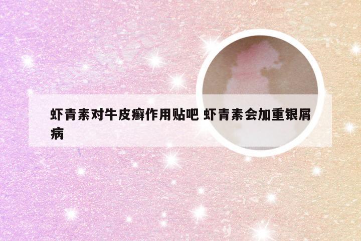 虾青素对牛皮癣作用贴吧 虾青素会加重银屑病