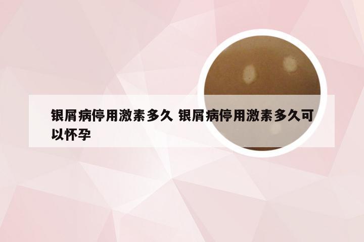 银屑病停用激素多久 银屑病停用激素多久可以怀孕