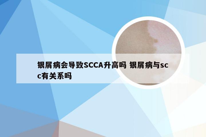 银屑病会导致SCCA升高吗 银屑病与scc有关系吗