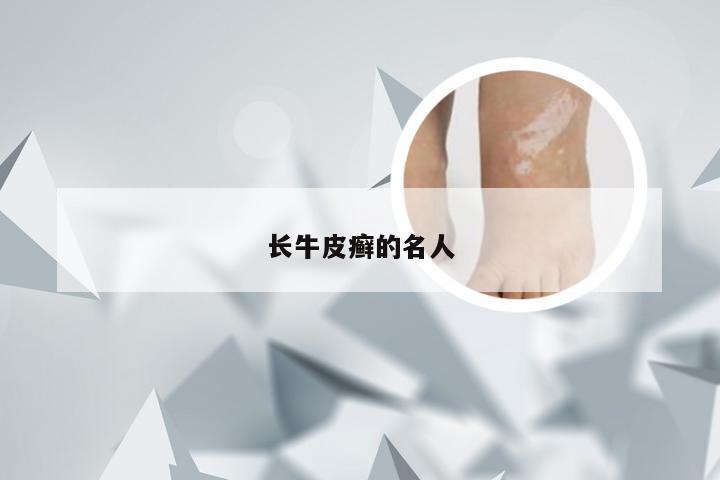 长牛皮癣的名人