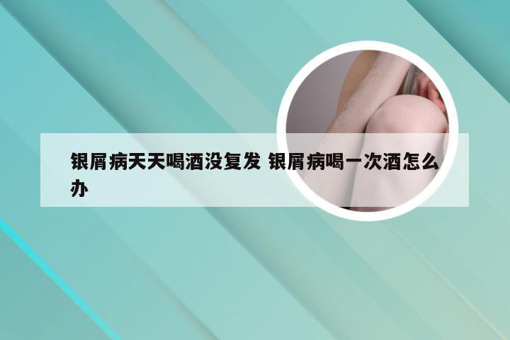 银屑病天天喝酒没复发 银屑病喝一次酒怎么办