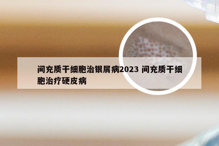 间充质干细胞治银屑病2023 间充质干细胞治疗硬皮病
