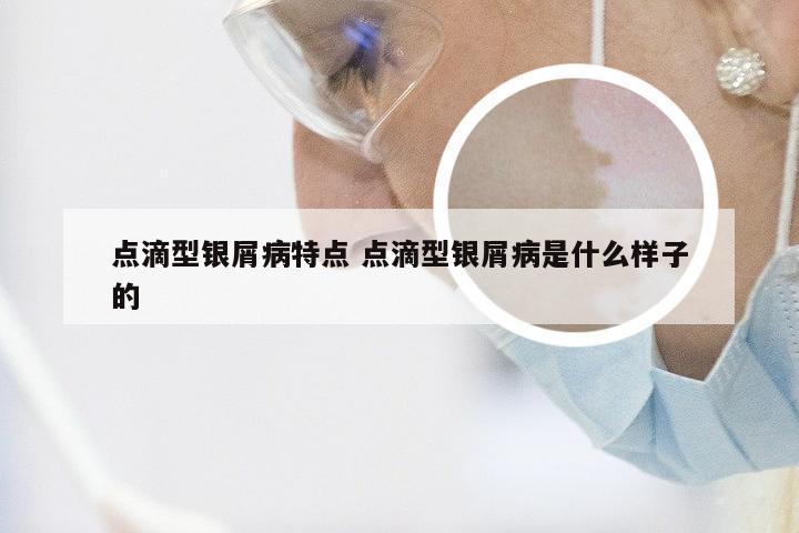 点滴型银屑病特点 点滴型银屑病是什么样子的