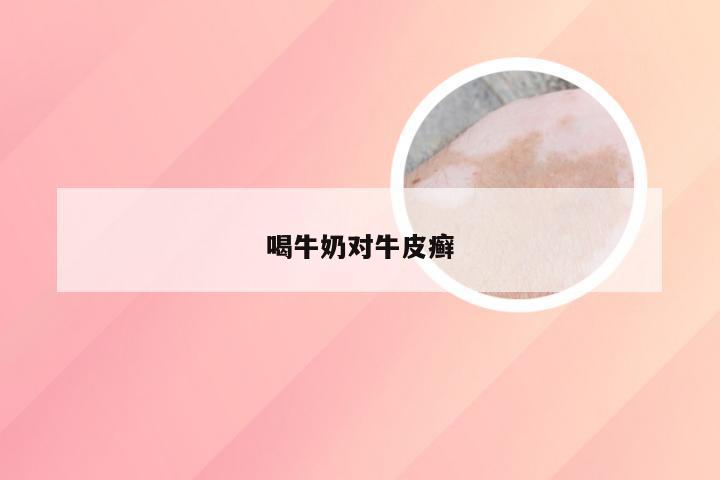 喝牛奶对牛皮癣
