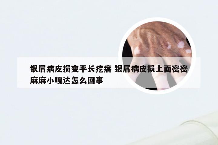 银屑病皮损变平长疙瘩 银屑病皮损上面密密麻麻小嘎达怎么回事