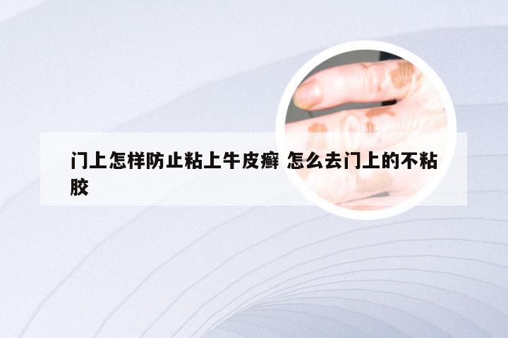 门上怎样防止粘上牛皮癣 怎么去门上的不粘胶