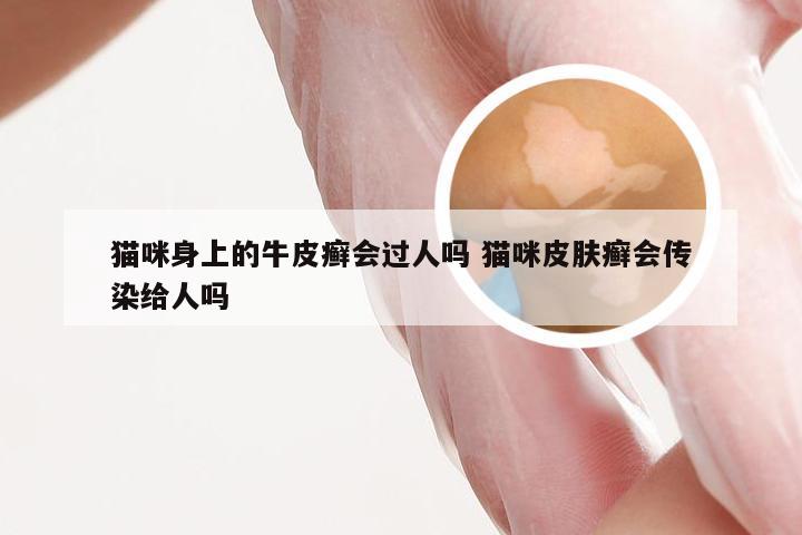 猫咪身上的牛皮癣会过人吗 猫咪皮肤癣会传染给人吗