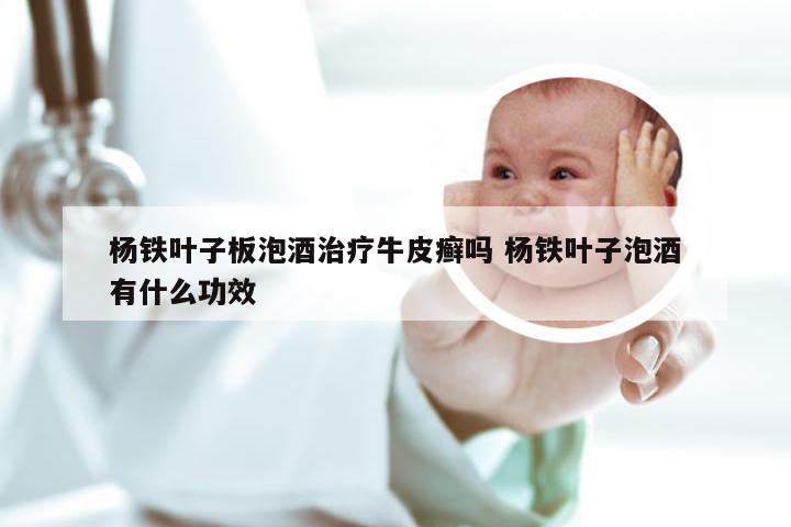 杨铁叶子板泡酒治疗牛皮癣吗 杨铁叶子泡酒有什么功效