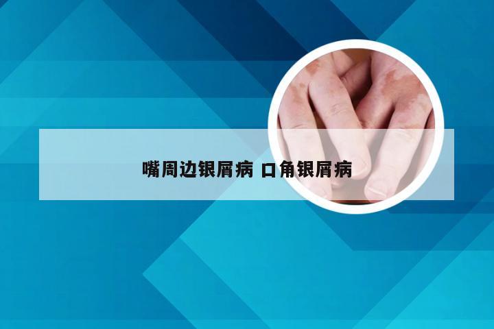 嘴周边银屑病 口角银屑病