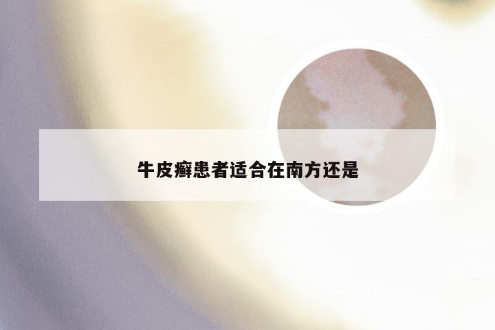 牛皮癣患者适合在南方还是
