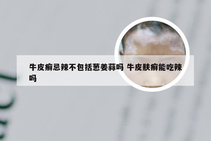 牛皮癣忌辣不包括葱姜蒜吗 牛皮肤癣能吃辣吗